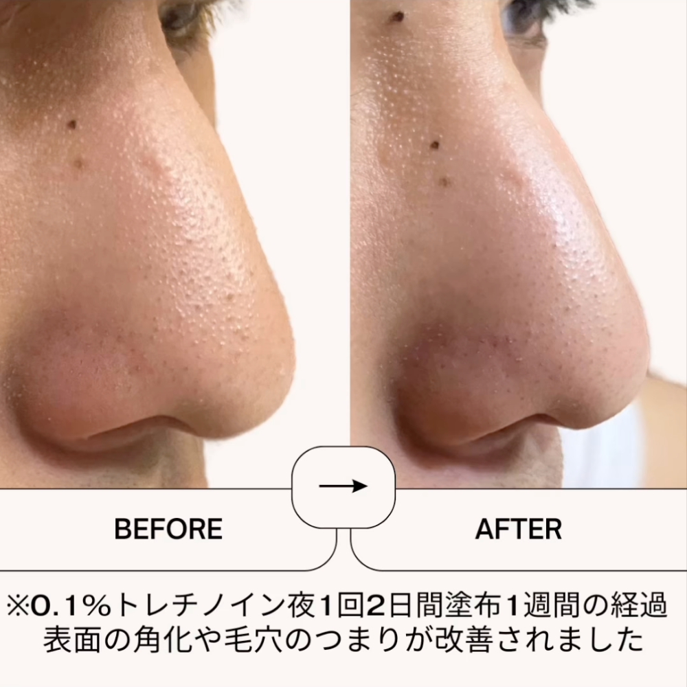 ゼオスキンヘルス RCクリーム 50ml