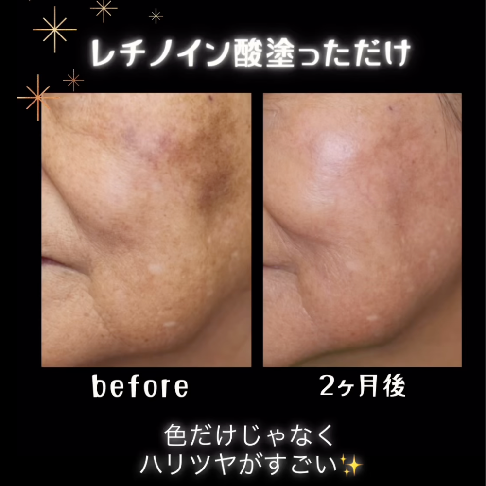 リビジョンスキンケア D·E·J Night face cream®（DEJナイトフェイスクリーム）※購入時にはカウンセリングが必要です