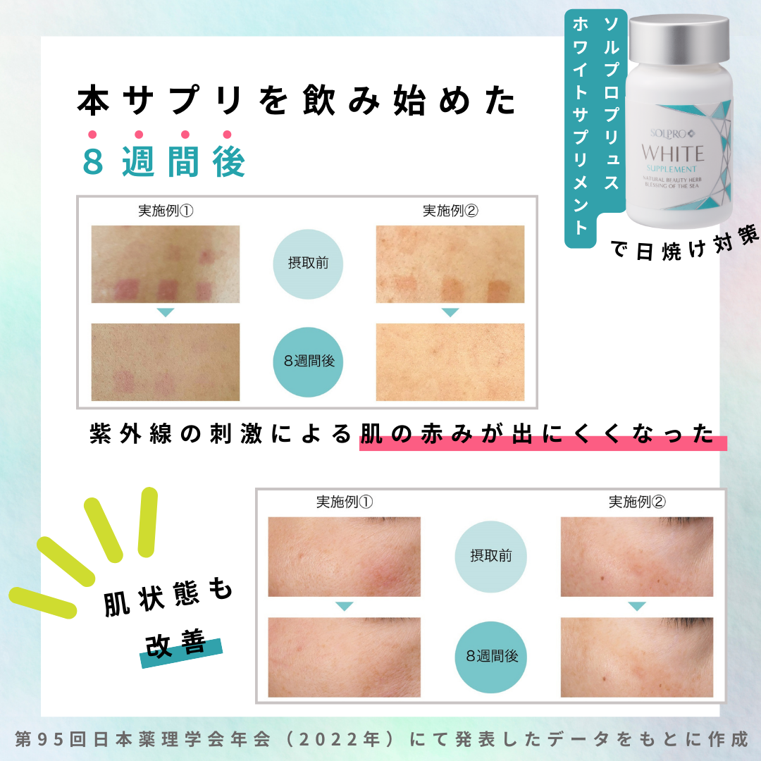 本アプリを飲み始めた8週間後、肌の赤みが出にくくなり肌状態も改善した