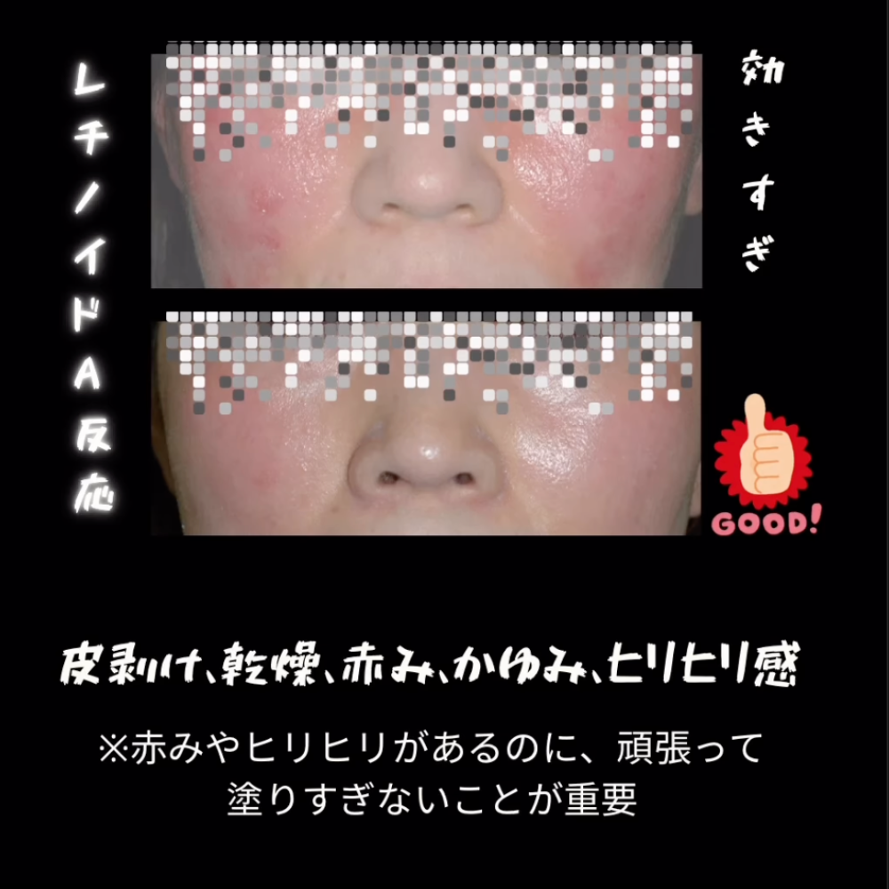 ゼオスキンヘルス スキンブライセラム0.25 50ml|レチノール0.25%配合 ゼオスキンヘルス スキンブライセラム0.25 50ml|レチノール0.25%配合