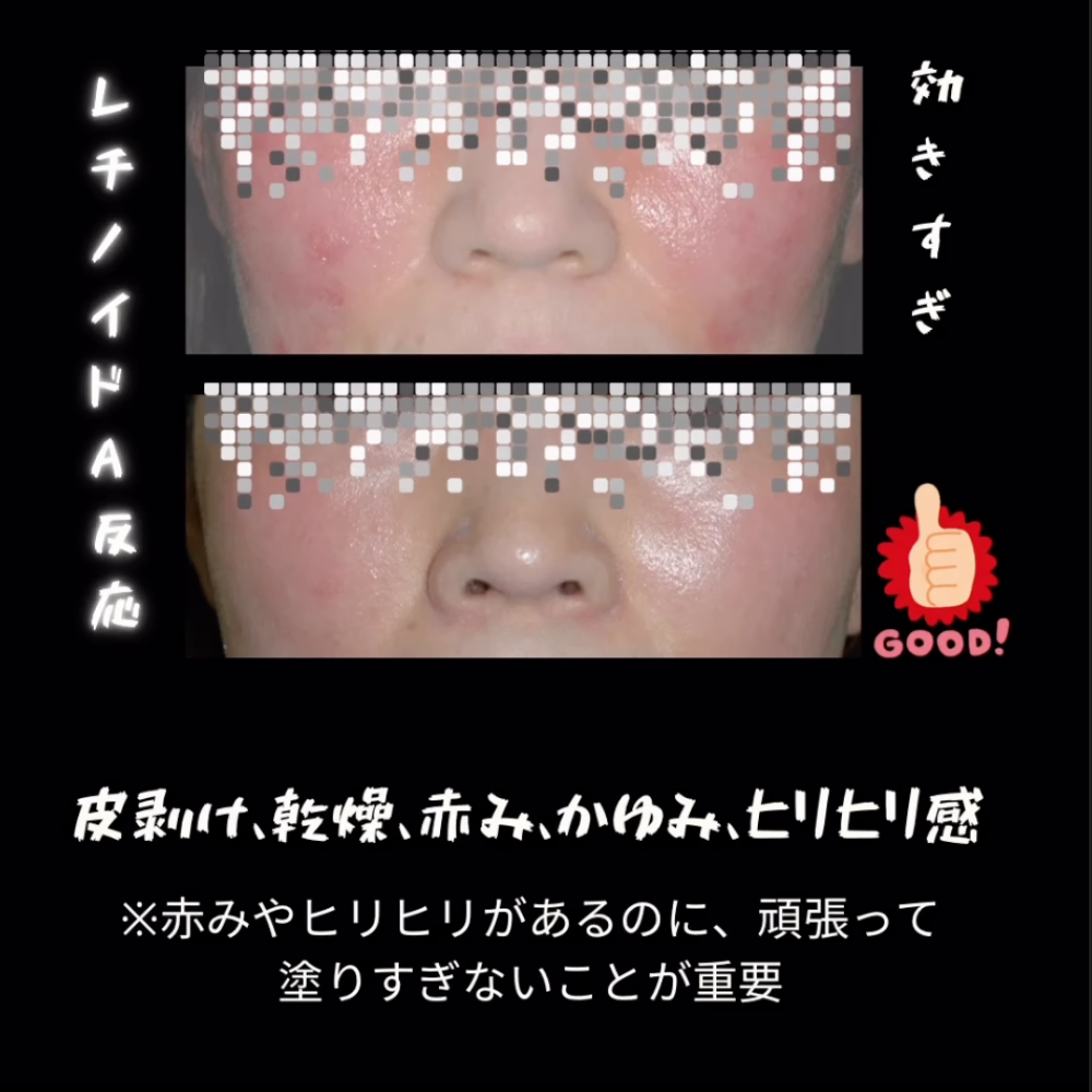 リビジョンスキンケア D·E·J Night face cream®（DEJナイトフェイスクリーム）※購入時にはカウンセリングが必要です